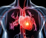 Study identifies new genes associated with heart attack risk largely affecting younger women