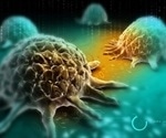 OncoAssure announces results of clinical study on novel prostate cancer test