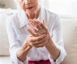 Increased risk of cardiovascular disease in psoriatic arthritis patients