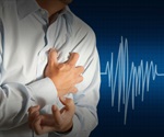 Mental disorders in adults aged 20–39 years linked to elevated risk of heart attack and stroke