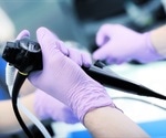 Miniature video capsule shows capabilities like a traditional tube-based endoscopy