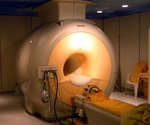 AI interpretations of MRI images could provide more accurate RA prediction